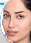 لنز رنگی سالانه Clear Vision (کلیر ویژن) | نرم و طبیعی